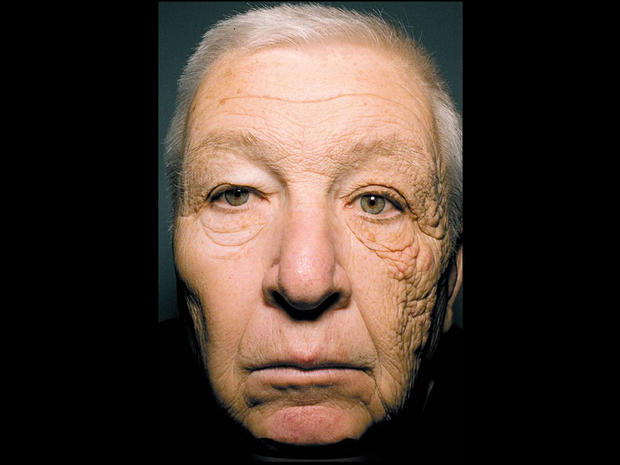 90% of your Wrinkles, fine lines, and leathery skin is a choice…